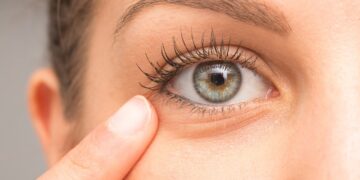 10 cosas que dicen los ojos sobre tu salud